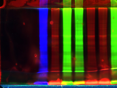 Electrophoresis