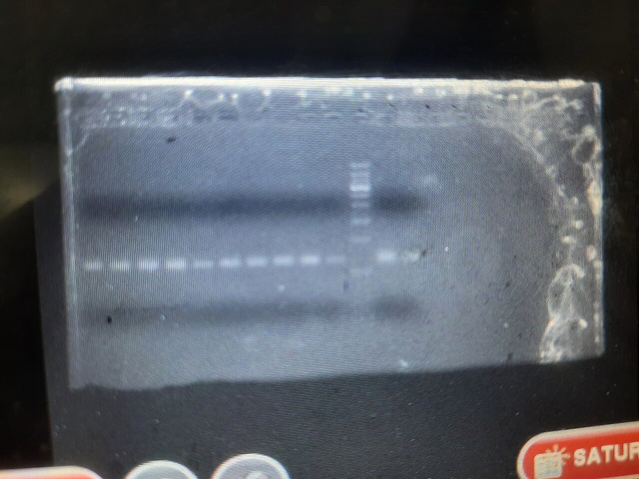 Electrophoresis